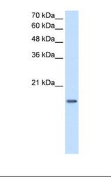 DUT / DUTPase Antibody - Jurkat cell lysate. Antibody concentration: 2.5 ug/ml. Gel concentration: 15%.  This image was taken for the unconjugated form of this product. Other forms have not been tested.