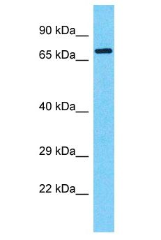 DUX4 Antibody - DUX4 antibody Western Blot of HCT15. Antibody dilution: 1 ug/ml.  This image was taken for the unconjugated form of this product. Other forms have not been tested.