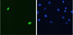 DUX4 Antibody - C2C12 myoblasts transfected with pCS2+DUX4 stained with P2B1. Counterstained with DAPI for nuclei.