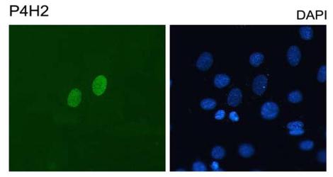 DUX4 Antibody - DUX4 Antibody (P4H2) - Immunofluorescence detection of human DUX4 on C2C12 mouse myoblasts transfected with pCS2-DUX4. Cells were counterstained with DAPI for nuclei.  This image was taken for the unconjugated form of this product. Other forms have not been tested.