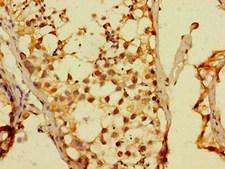 DUX4 Antibody - Immunohistochemistry of paraffin-embedded human testis tissue at dilution of 1:100