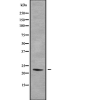 DUX5 Antibody - Western blot analysis of DUX5 using HeLa whole cells lysates