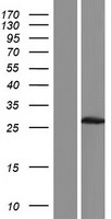 DUXA Protein - Western validation with an anti-DDK antibody * L: Control HEK293 lysate R: Over-expression lysate
