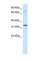 Duxbl Antibody - DUXBL antibody ARP37608_P050-NP_899245-1110051B16RIK Antibody Western blot of SP2/0 cell lysate.  This image was taken for the unconjugated form of this product. Other forms have not been tested.