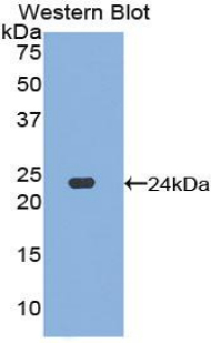 DVL1 / DVL / Dishevelled Antibody - Western blot of recombinant DVL1 / DVL / Dishevelled.  This image was taken for the unconjugated form of this product. Other forms have not been tested.