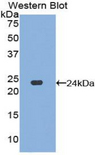 DVL1 / DVL / Dishevelled Antibody - Western blot of recombinant DVL1 / DVL / Dishevelled.  This image was taken for the unconjugated form of this product. Other forms have not been tested.