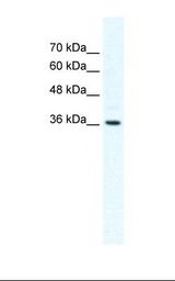 DVL1 / DVL / Dishevelled Antibody - HepG2 cell lysate. Antibody concentration: 2.5 ug/ml. Gel concentration: 12%.  This image was taken for the unconjugated form of this product. Other forms have not been tested.