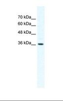 DVL1 / DVL / Dishevelled Antibody - HepG2 cell lysate. Antibody concentration: 2.5 ug/ml. Gel concentration: 12%.  This image was taken for the unconjugated form of this product. Other forms have not been tested.