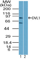 DVL1 / DVL / Dishevelled Antibody - Western blot of DVL-1 in Raji cell lysate in the 1) absence and 2) presence of immunizing peptide using Polyclonal Antibody to DVL-1 at 6 ug/ml. Goat anti-rabbit Ig HRP secondary antibody, and PicoTect ECL substrate solution, were used for this test.