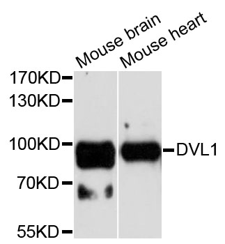 DVL1 / DVL / Dishevelled Antibody - Western blot analysis of extracts of various cell lines, using DVL1 antibody at 1:1000 dilution. The secondary antibody used was an HRP Goat Anti-Rabbit IgG (H+L) at 1:10000 dilution. Lysates were loaded 25ug per lane and 3% nonfat dry milk in TBST was used for blocking. An ECL Kit was used for detection and the exposure time was 60s.
