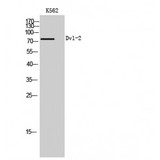 DVL2 / Dishevelled 2 Antibody - Western blot of Dvl-2 antibody