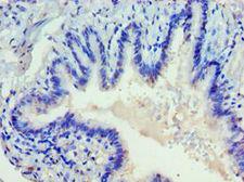 DVL2 / Dishevelled 2 Antibody - Immunohistochemistry of paraffin-embedded human lung using antibody at 1:100 dilution.