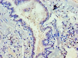 DVL2 / Dishevelled 2 Antibody - Immunohistochemistry of paraffin-embedded human lung using antibody at 1:100 dilution.
