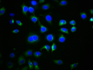 DVL2 / Dishevelled 2 Antibody - Immunofluorescence staining of A549 cells with DVL2 Antibody at 1:77, counter-stained with DAPI. The cells were fixed in 4% formaldehyde, permeabilized using 0.2% Triton X-100 and blocked in 10% normal Goat Serum. The cells were then incubated with the antibody overnight at 4°C. The secondary antibody was Alexa Fluor 488-congugated AffiniPure Goat Anti-Rabbit IgG(H+L).