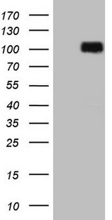DVL2 / Dishevelled 2 Antibody - HEK293T cells were transfected with the pCMV6-ENTRY control. (Left lane) or pCMV6-ENTRY DVL2. (Right lane) cDNA for 48 hrs and lysed. Equivalent amounts of cell lysates. (5 ug per lane) were separated by SDS-PAGE and immunoblotted with anti-DVL2.