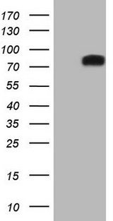 DVL2 / Dishevelled 2 Antibody - HEK293T cells were transfected with the pCMV6-ENTRY control (Left lane) or pCMV6-ENTRY DVL2 (Right lane) cDNA for 48 hrs and lysed. Equivalent amounts of cell lysates (5 ug per lane) were separated by SDS-PAGE and immunoblotted with anti-DVL2.