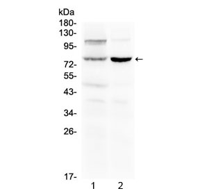 DVL2 / Dishevelled 2 Antibody - Western blot testing of 1) rat liver and 2) mouse kidney lysate with Dishevelled 2 antibody at 0.5ug/ml. Predicted molecular weight ~79 kDa, can be observed at 90-95 kDa.