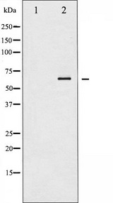DVL2 / Dishevelled 2 Antibody - Western blot analysis of extracts of K562/Jurkat cells using DVL2 antibody. The lane on the left is treated with the antigen-specific peptide.