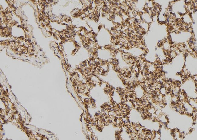 DVL2 / Dishevelled 2 Antibody - 1:100 staining rat lung tissue by IHC-P. The sample was formaldehyde fixed and a heat mediated antigen retrieval step in citrate buffer was performed. The sample was then blocked and incubated with the antibody for 1.5 hours at 22°C. An HRP conjugated goat anti-rabbit antibody was used as the secondary.