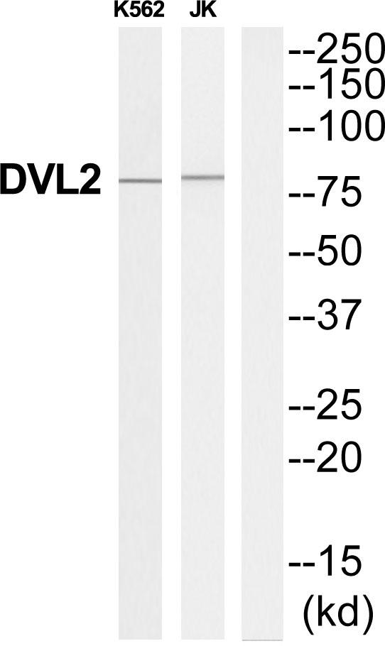 DVL2 / Dishevelled 2 Antibody - Western blot analysis of extracts from K562/Jurkat cells, using DVL2 antibody.