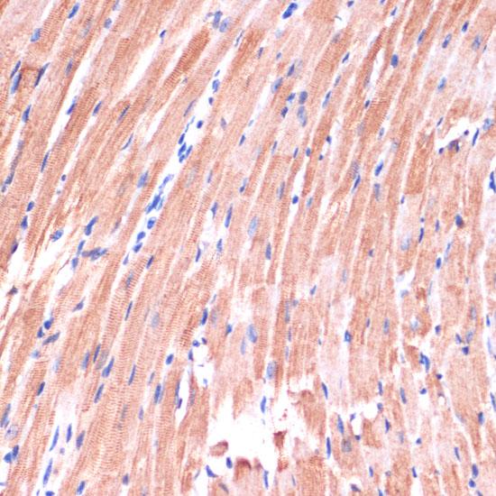 DVL2 / Dishevelled 2 Antibody - Immunohistochemistry of paraffin-embedded Mouse heart using DVL2 Polyclonal Antibody at dilution of 1:100 (40x lens).