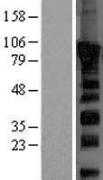DVL2 / Dishevelled 2 Protein - Western validation with an anti-DDK antibody * L: Control HEK293 lysate R: Over-expression lysate