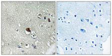 DVL3 / Dishevelled 3 Antibody - Immunohistochemistry analysis of paraffin-embedded human brain tissue, using DVL3 Antibody. The picture on the right is blocked with the synthesized peptide.