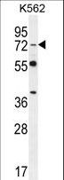 DVL3 / Dishevelled 3 Antibody - DVL3 Antibody western blot of K562 cell line lysates (35 ug/lane). The DVL3 antibody detected the DVL3 protein (arrow).