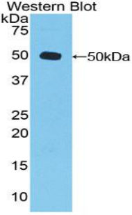 DVL3 / Dishevelled 3 Antibody - Western blot of recombinant DVL3 / Dishevelled 3.  This image was taken for the unconjugated form of this product. Other forms have not been tested.