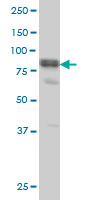 DVL3 / Dishevelled 3 Antibody - DVL3 monoclonal antibody (M04), clone 4H2 Western Blot analysis of DVL3 expression in A-431.