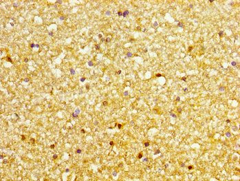 DVL3 / Dishevelled 3 Antibody - Immunohistochemistry image at a dilution of 1:200 and staining in paraffin-embedded human brain tissue performed on a Leica BondTM system. After dewaxing and hydration, antigen retrieval was mediated by high pressure in a citrate buffer (pH 6.0) . Section was blocked with 10% normal goat serum 30min at RT. Then primary antibody (1% BSA) was incubated at 4 °C overnight. The primary is detected by a biotinylated secondary antibody and visualized using an HRP conjugated SP system.