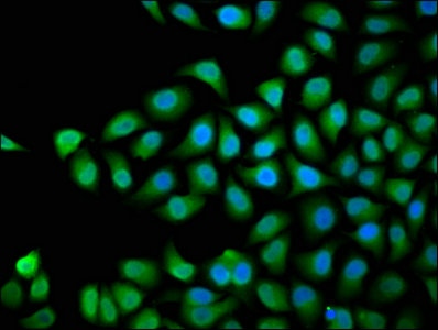 DVL3 / Dishevelled 3 Antibody - Immunofluorescence staining of Hela cells with DVL3 Antibody at 1:66, counter-stained with DAPI. The cells were fixed in 4% formaldehyde, permeabilized using 0.2% Triton X-100 and blocked in 10% normal Goat Serum. The cells were then incubated with the antibody overnight at 4°C. The secondary antibody was Alexa Fluor 488-congugated AffiniPure Goat Anti-Rabbit IgG(H+L).