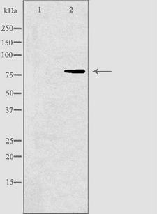 DVL3 / Dishevelled 3 Antibody - Western blot analysis of extracts of Jurkat cells using DVL3 antibody. The lane on the left is treated with the antigen-specific peptide.
