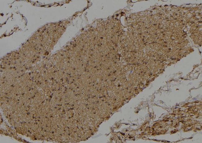 DVL3 / Dishevelled 3 Antibody - 1:100 staining human gastric tissue by IHC-P. The sample was formaldehyde fixed and a heat mediated antigen retrieval step in citrate buffer was performed. The sample was then blocked and incubated with the antibody for 1.5 hours at 22°C. An HRP conjugated goat anti-rabbit antibody was used as the secondary.