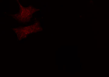 DVL3 / Dishevelled 3 Antibody - Staining HeLa cells by IF/ICC. The samples were fixed with PFA and permeabilized in 0.1% Triton X-100, then blocked in 10% serum for 45 min at 25°C. The primary antibody was diluted at 1:200 and incubated with the sample for 1 hour at 37°C. An Alexa Fluor 594 conjugated goat anti-rabbit IgG (H+L) antibody, diluted at 1/600, was used as secondary antibody.