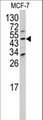 DXO / DOM3Z Antibody - Western blot of DOM3Z antibody (N-term Y88) in MCF-7 cell line lysates (35 ug/lane). DOM3Z (arrow) was detected using the purified antibody.