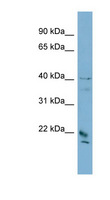 DYDC1 Antibody - DYDC1 antibody Western blot of PANC1 cell lysate. This image was taken for the unconjugated form of this product. Other forms have not been tested.