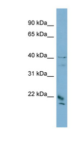 DYDC1 Antibody - DYDC1 antibody Western blot of PANC1 cell lysate. This image was taken for the unconjugated form of this product. Other forms have not been tested.
