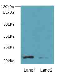 DYDC1 Antibody - Western blot. All lanes: DYDC1 antibody at 4 ug/ml. Lane 1: HeLa whole cell lysate. Lane 2: HepG-2 whole cell lysate. Secondary Goat polyclonal to Rabbit IgG at 1:10000 dilution. Predicted band size: 21 kDa. Observed band size: 21 kDa.