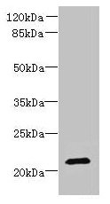 DYDC1 Antibody - Western blot All lanes: DYDC1 antibody at 4µg/ml Lane 1: Hela whole cell lysate Lane 2: HepG2 whole cell lysate Secondary Goat polyclonal to rabbit IgG at 1/10000 dilution Predicted band size: 21, 22 kDa Observed band size: 21 kDa