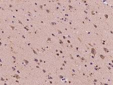 DYDC1 Antibody - Immunochemical staining of human DYDC1 in human brain with rabbit polyclonal antibody at 1:100 dilution, formalin-fixed paraffin embedded sections.