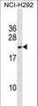 DYDC2 Antibody - DYDC2 Antibody western blot of NCI-H292 cell line lysates (35 ug/lane). The DYDC2 antibody detected the DYDC2 protein (arrow).