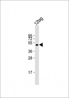 DYKDDDDK Tag Antibody - Anti-FLAG Tag Antibody at 1:2000 dilution + 12tag protein lysate Lysates/proteins at 20 ug per lane. Secondary Goat Anti-mouse IgG, (H+L), Peroxidase conjugated at 1:10000 dilution. Predicted band size: 48 kDa. Blocking/Dilution buffer: 5% NFDM/TBST.