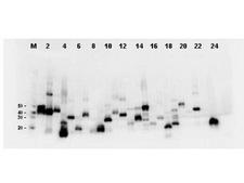 DYKDDDDK Tag Antibody - Western Blot-Monoclonal Antibody to detect FLAG conjugated proteins. Twenty-four (24) clones were randomly selected and grown up from glycerol stocks by inoculating 0.5mL 2xYT medium. expression of recombinant proteins was induced by the addition of IPTG. Proteins were purified by nickel affinity chromatography and eluted in 40 ul. Samples were diluted 10-fold, transferred to nitrocellulose membrane and blotted using Mab-anti-FLAG antibody. Personal Communication: A. Morrison and B. Kloss, NYCOMPS, New York, NY.