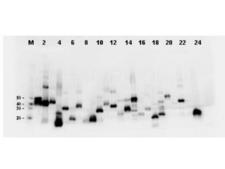 DYKDDDDK Tag Antibody - Twenty-four (24) clones were randomly selected and grown up from glycerol stocks by inoculating 0.5mL 2xYT medium. Expression of recombinant proteins was induced by the addition of IPTG. Proteins were purified by nickel affinity chromatography and eluted in 40 µL. Samples were diluted 10-fold, transferred to nitrocellulose membrane and blotted using Mab-anti-FLAG™ antibody. Personal Communication: A. Morrison and B. Kloss, NYCOMPS, New York, NY.