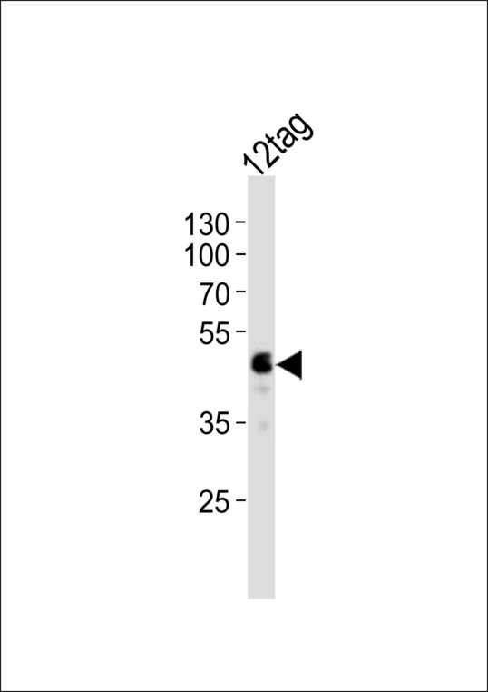 DYKDDDDK Tag Antibody - Western blot of lysate from 12tag protein, using FLAG tag antibody (DYKDDDDK). Antibody was diluted at 1:1000. A goat anti-rabbit IgG H&L (HRP) at 1:10000 dilution was used as the secondary antibody. Lysate at 20ug.