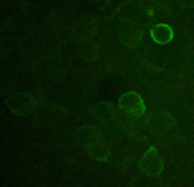 DYKDDDDK Tag Antibody - Immunofluorescence of HEK293 cells transfected with Flag-tagged CD4 protein using DYKDDDDK-tag Antibody (DYKDDDDK-tag Antibody, pAb, Rabbit, 10 ug/ml)