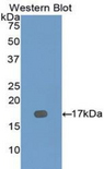 DYM Antibody - Western blot of recombinant DYM.  This image was taken for the unconjugated form of this product. Other forms have not been tested.
