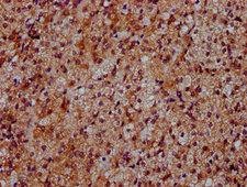 DYM Antibody - Immunohistochemistry Dilution at 1:500 and staining in paraffin-embedded human adrenal gland tissue performed on a Leica BondTM system. After dewaxing and hydration, antigen retrieval was mediated by high pressure in a citrate buffer (pH 6.0). Section was blocked with 10% normal Goat serum 30min at RT. Then primary antibody (1% BSA) was incubated at 4°C overnight. The primary is detected by a biotinylated Secondary antibody and visualized using an HRP conjugated SP system.