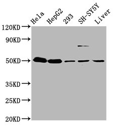 DYM Antibody - Western Blot Positive WB detected in: Hela whole cell lysate, HepG2 whole cell lysate, 293 whole cell lysate, SH-SY5Y whole cell lysate, Mouse liver tissue All Lanes: DYM antibody at 3.7µg/ml Secondary Goat polyclonal to rabbit IgG at 1/50000 dilution Predicted band size: 76, 55 KDa Observed band size: 55 KDa